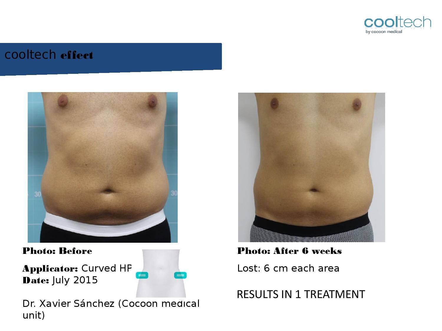 Presentation Cooltech ENG Wigmore Days Novaaaa1-page-009